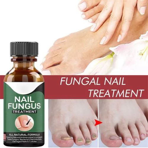 Fast Nail Fungus Treatment & Repair Serum – Anti-Fungal Nail Care Gel for Healthy, Strong Nails