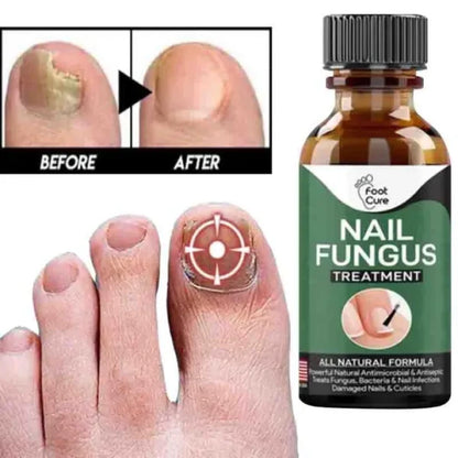 Fast Nail Fungus Treatment & Repair Serum – Anti-Fungal Nail Care Gel for Healthy, Strong Nails